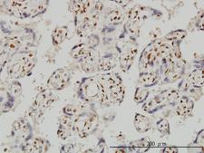 FOXR2 Antibody - Immunoperoxidase of monoclonal antibody to FOXR2 on formalin-fixed paraffin-embedded human placenta. [antibody concentration 3 ug/ml].