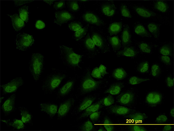 FOXR2 Antibody - Immunofluorescence of monoclonal antibody to FOXR2 on HeLa cell. [antibody concentration 10 ug/ml]
