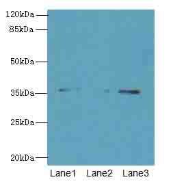 FOXR2 Antibody - Western blot. All lanes: FOXR2 antibody at 4 ug/ml. Lane 1: SH-SY5Y whole cell lysate. Lane 2: Jurkat whole cell lysate. Lane 3: HeLa whole cell lysate. Secondary Goat polyclonal to Rabbit IgG at 1:10000 dilution. Predicted band size: 36 kDa. Observed band size: 36 kDa.