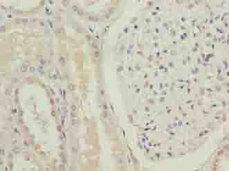 FOXR2 Antibody - Immunohistochemistry of paraffin-embedded human kidney tissue using antibody at dilution of 1:100.