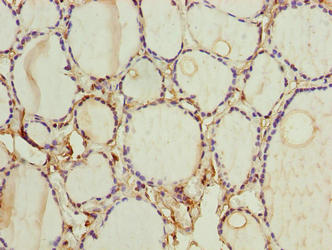 FOXR2 Antibody - Immunohistochemistry of paraffin-embedded human thyroid tissue using FOXR2 Antibody at dilution of 1:100