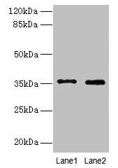 FOXR2 Antibody - Western blot All lanes: FOXR2 antibody at 4µg/ml Lane 1: SH-SY5Y whole cell lysate Lane 2: Jurkat whole cell lysate Lane 3: Hela whole cell lysate Secondary Goat polyclonal to rabbit IgG at 1/10000 dilution Predicted band size: 36 kDa Observed band size: 36 kDa