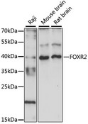 FOXR2 Antibody - Western blot analysis of extracts of various cell lines, using FOXR2 antibody at 1:1000 dilution. The secondary antibody used was an HRP Goat Anti-Rabbit IgG (H+L) at 1:10000 dilution. Lysates were loaded 25ug per lane and 3% nonfat dry milk in TBST was used for blocking. An ECL Kit was used for detection and the exposure time was 90s.