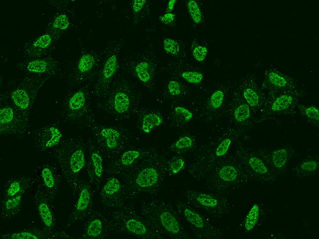 FOXR2 Antibody - Immunofluorescence staining of FOXR2 in U2OS cells. Cells were fixed with 4% PFA, permeabilzed with 0.3% Triton X-100 in PBS, blocked with 10% serum, and incubated with rabbit anti-Human FOXR2 polyclonal antibody (dilution ratio 1:200) at 4°C overnight. Then cells were stained with the Alexa Fluor 488-conjugated Goat Anti-rabbit IgG secondary antibody (green). Positive staining was localized to Nucleus.