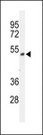 FOXRED1 Antibody - Western blot of FXRD1 Antibody in NCI-H460 cell line lysates (35 ug/lane). FXRD1 (arrow) was detected using the purified antibody.