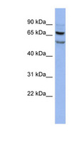 FOXRED1 Antibody - FOXRED1 antibody Western blot of HT1080 cell lysate. This image was taken for the unconjugated form of this product. Other forms have not been tested.