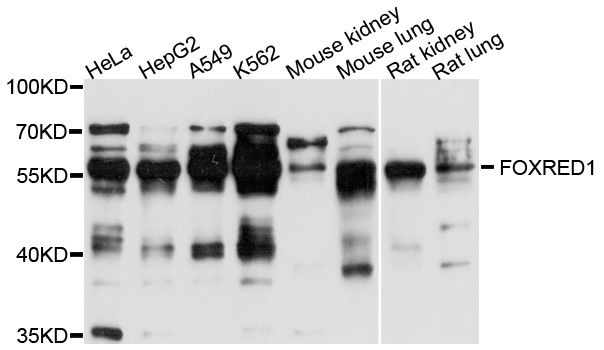 FOXRED1 Antibody - Western blot analysis of extracts of various cell lines, using FOXRED1 antibody at 1:1000 dilution. The secondary antibody used was an HRP Goat Anti-Rabbit IgG (H+L) at 1:10000 dilution. Lysates were loaded 25ug per lane and 3% nonfat dry milk in TBST was used for blocking. An ECL Kit was used for detection and the exposure time was 60s.