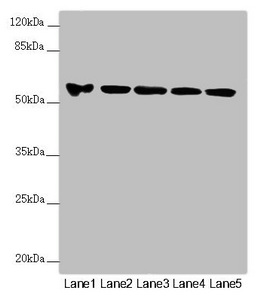 FOXRED1 Antibody - Western blot All Lanes: FOXRED1 antibody at 5.8 ug/ml Lane 1: A549 whole cell lysate Lane 2: A431 whole cell lysate Lane 3: Jurkat whole cell lysate Lane 4: Hela whole cell lysate Lane 5: HepG-2 whole cell lysate Secondary Goat polyclonal to rabbit IgG at 1/10000 dilution Predicted band size: 54,31,53 kDa Observed band size: 54 kDa