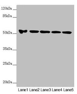 FOXRED1 Antibody - Western blot All lanes: FOXRED1 antibody at 5.8µg/ml Lane 1: A549 whole cell lysate Lane 2: A431 whole cell lysate Lane 3: Jurkat whole cell lysate Lane 4: Hela whole cell lysate Lane 5: HepG2 whole cell lysate Secondary Goat polyclonal to rabbit IgG at 1/10000 dilution Predicted band size: 54, 31, 53 kDa Observed band size: 54 kDa