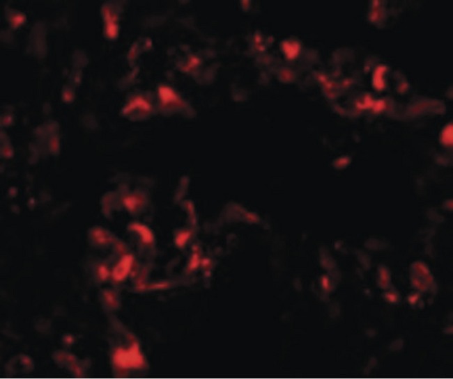 FOXRED2 Antibody - Immunofluorescence of FOXRED2 in human lung cells with FOXRED2 antibody at 20 ug/ml.