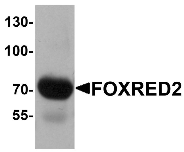 FOXRED2 Antibody - Western blot analysis of FOXRED2 in human lung tissue lysate with FOXRED2 antibody at 1 ug/ml.