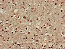 FOXRED2 Antibody - Immunohistochemistry of paraffin-embedded human brain tissue at dilution of 1:100