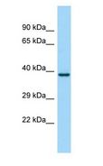 FP / PTGFR Antibody - FP / PTGFR antibody Western Blot of Fetal kidney.  This image was taken for the unconjugated form of this product. Other forms have not been tested.