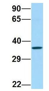 FP / PTGFR Antibody - FP / PTGFR antibody Western Blot of 721_B lysate. Antibody Dilution: 1.0 ug/ml. PTGFR is supported by BioGPS gene expression data to be expressed in 721_B. Antibody dilution: 1 ug/ml.  This image was taken for the unconjugated form of this product. Other forms have not been tested.