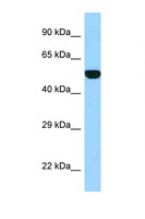 FPGS Antibody - FPGS antibody Western blot of Fetal Heart lysate. Antibody concentration 1 ug/ml.  This image was taken for the unconjugated form of this product. Other forms have not been tested.