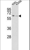 FPGS Antibody - Western blot of FPGS Antibody in K562, A2058 cell line lysates (35 ug/lane). FPGS (arrow) was detected using the purified antibody.