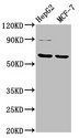FPGS Antibody - Western Blot Positive WB detected in: HepG2 whole cell lysate, MCF-7 whole cell lysate All Lanes: FPGS antibody at 3.2µg/ml Secondary Goat polyclonal to rabbit IgG at 1/50000 dilution Predicted band size: 65, 61, 60, 62 KDa Observed band size: 65 KDa