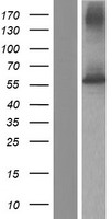 FPGS Protein - Western validation with an anti-DDK antibody * L: Control HEK293 lysate R: Over-expression lysate