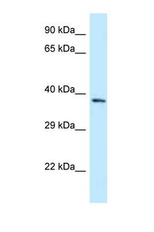 FPGT Antibody - FPGT antibody Western blot of Fetal Liver lysate. Antibody concentration 1 ug/ml.  This image was taken for the unconjugated form of this product. Other forms have not been tested.
