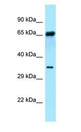 FPGT Antibody - FPGT antibody Western Blot of ACHN.  This image was taken for the unconjugated form of this product. Other forms have not been tested.