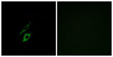 FPR1 / FPR Antibody - Immunofluorescence analysis of A549 cells, using FPR1 Antibody. The picture on the right is blocked with the synthesized peptide.