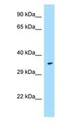FPR1 / FPR Antibody - FPR1 / FPR antibody Western Blot of Fetal Heart.  This image was taken for the unconjugated form of this product. Other forms have not been tested.