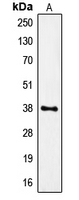 FPR1 / FPR Antibody - Western blot analysis of FPR1 expression in U87MG (A) whole cell lysates.