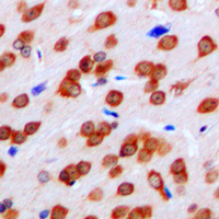 FPR1 / FPR Antibody - Immunohistochemical analysis of FPR1 staining in human brain formalin fixed paraffin embedded tissue section. The section was pre-treated using heat mediated antigen retrieval with sodium citrate buffer (pH 6.0). The section was then incubated with the antibody at room temperature and detected using an HRP conjugated compact polymer system. DAB was used as the chromogen. The section was then counterstained with hematoxylin and mounted with DPX.