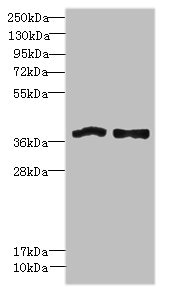 FPR1 / FPR Antibody - Western blot All lanes: FPR1 antibody at 6µg/ml Lane 1: Colo320 whole cell lysate Lane 2: HT29 whole cell lysate Secondary Goat polyclonal to rabbit IgG at 1/10000 dilution Predicted band size: 38 kDa Observed band size: 38 kDa