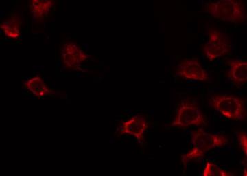 FPR1 / FPR Antibody - Staining HeLa cells by IF/ICC. The samples were fixed with PFA and permeabilized in 0.1% Triton X-100, then blocked in 10% serum for 45 min at 25°C. The primary antibody was diluted at 1:200 and incubated with the sample for 1 hour at 37°C. An Alexa Fluor 594 conjugated goat anti-rabbit IgG (H+L) Ab, diluted at 1/600, was used as the secondary antibody.