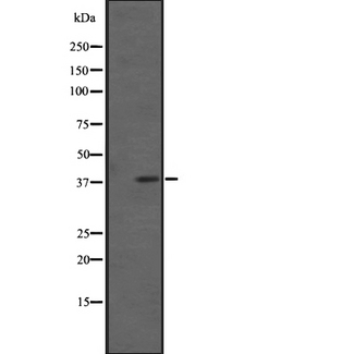 FPR2 / FPRL1 Antibody - Western blot analysis of FPRL1 expression in extracts of HL-60 cells.. The lane on the left is treated with the antigen-specific peptide.
