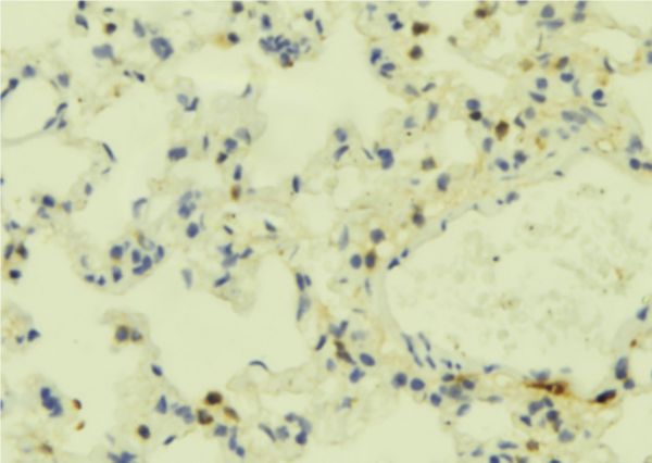 FPR2 / FPRL1 Antibody - 1:100 staining mouse lung tissue by IHC-P. The sample was formaldehyde fixed and a heat mediated antigen retrieval step in citrate buffer was performed. The sample was then blocked and incubated with the antibody for 1.5 hours at 22°C. An HRP conjugated goat anti-rabbit antibody was used as the secondary.