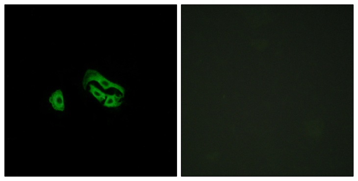 FPR3 / FPRL2 Antibody - Immunofluorescence analysis of HeLa cells, using FPRL2 Antibody. The picture on the right is blocked with the synthesized peptide.