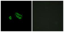 FPR3 / FPRL2 Antibody - Immunofluorescence analysis of HeLa cells, using FPRL2 Antibody. The picture on the right is blocked with the synthesized peptide.