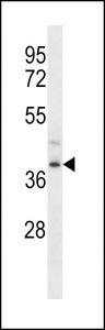 FPR3 / FPRL2 Antibody - FPR3 Antibody western blot of ZR-75-1 cell line lysates (35 ug/lane). The FPR3 antibody detected the FPR3 protein (arrow).