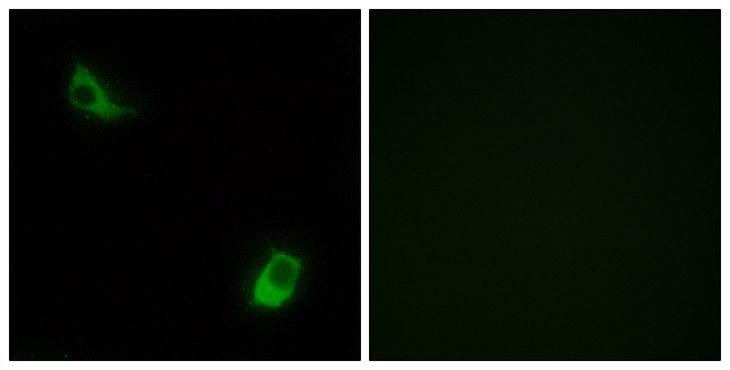 FPR3 / FPRL2 Antibody - Peptide - + Immunofluorescence analysis of LOVO cells, using FPRL2 antibody.