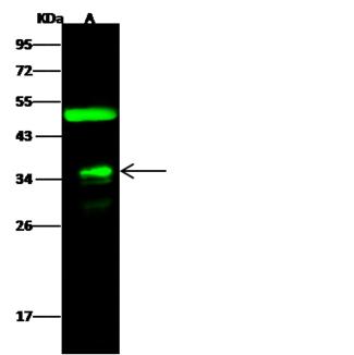 FR4 / Folate Receptor 4 Antibody - Anti-FOLR4 rabbit polyclonal antibody at 1:500 dilution. Lane A: MCF7 Whole Cell Lysate. Lysates/proteins at 30 ug per lane. Secondary: Goat Anti-Rabbit IgG H&L (Dylight 800) at 1/10000 dilution. Developed using the Odyssey technique. Performed under reducing conditions. Predicted band size: 29 kDa. Observed band size: 35 kDa. (We are unsure as to the identity of these extra bands.)