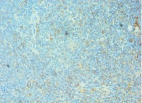 FRA-1 / FOSL1 Antibody - Immunohistochemistry of paraffin-embedded human tonsil using antibody at 1:100 dilution.