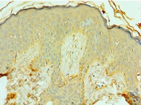 FRA-1 / FOSL1 Antibody - Immunohistochemistry of paraffin-embedded human skin using antibody at 1:100 dilution.