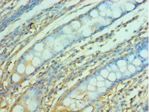 FRA-1 / FOSL1 Antibody - Immunohistochemistry of paraffin-embedded human rectum using antibody at 1:100 dilution.