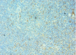 FRA-1 / FOSL1 Antibody - Immunohistochemistry of paraffin-embedded human tonsil tissue using FOSL1 Antibody at dilution of 1:100