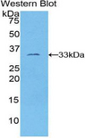 FRA-1 / FOSL1 Antibody - Western blot of recombinant FRA-1 / FOSL1.  This image was taken for the unconjugated form of this product. Other forms have not been tested.