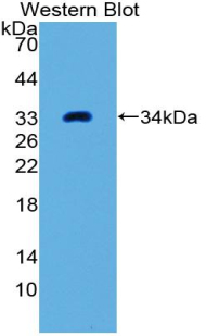 FRA-1 / FOSL1 Antibody - Western blot of FRA-1 / FOSL1 antibody.