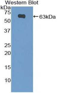 FRA-1 / FOSL1 Antibody - Western blot of recombinant FRA-1 / FOSL1.