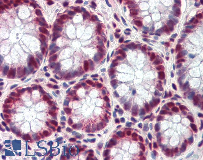 FRA-1 / FOSL1 Antibody - Colon: Formalin-Fixed, Paraffin-Embedded (FFPE).  This image was taken for the unconjugated form of this product. Other forms have not been tested.