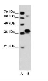 FRA-1 / FOSL1 Antibody - A: Marker, B: Jurkat Cell Lysate.  This image was taken for the unconjugated form of this product. Other forms have not been tested.