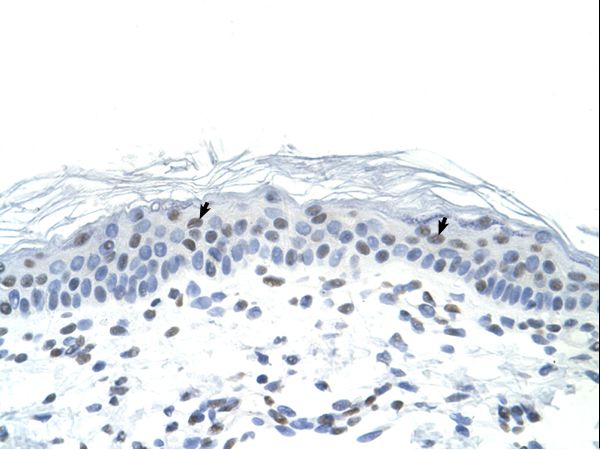 FRA-1 / FOSL1 Antibody - Human Skin.  This image was taken for the unconjugated form of this product. Other forms have not been tested.