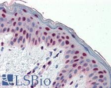 FRA-1 / FOSL1 Antibody - Anti-FOSL1 / FRA1 antibody IHC of human skin. Immunohistochemistry of formalin-fixed, paraffin-embedded tissue after heat-induced antigen retrieval. Antibody concentration 5 ug/ml.  This image was taken for the unconjugated form of this product. Other forms have not been tested.