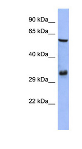 FRA-1 / FOSL1 Antibody - FOSL1 / FRA1 antibody Western blot of HepG2 cell lysate. This image was taken for the unconjugated form of this product. Other forms have not been tested.
