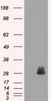 FRA-1 / FOSL1 Antibody - HEK293T cells were transfected with the pCMV6-ENTRY control (Left lane) or pCMV6-ENTRY FOSL1 (Right lane) cDNA for 48 hrs and lysed. Equivalent amounts of cell lysates (5 ug per lane) were separated by SDS-PAGE and immunoblotted with anti-FOSL1.